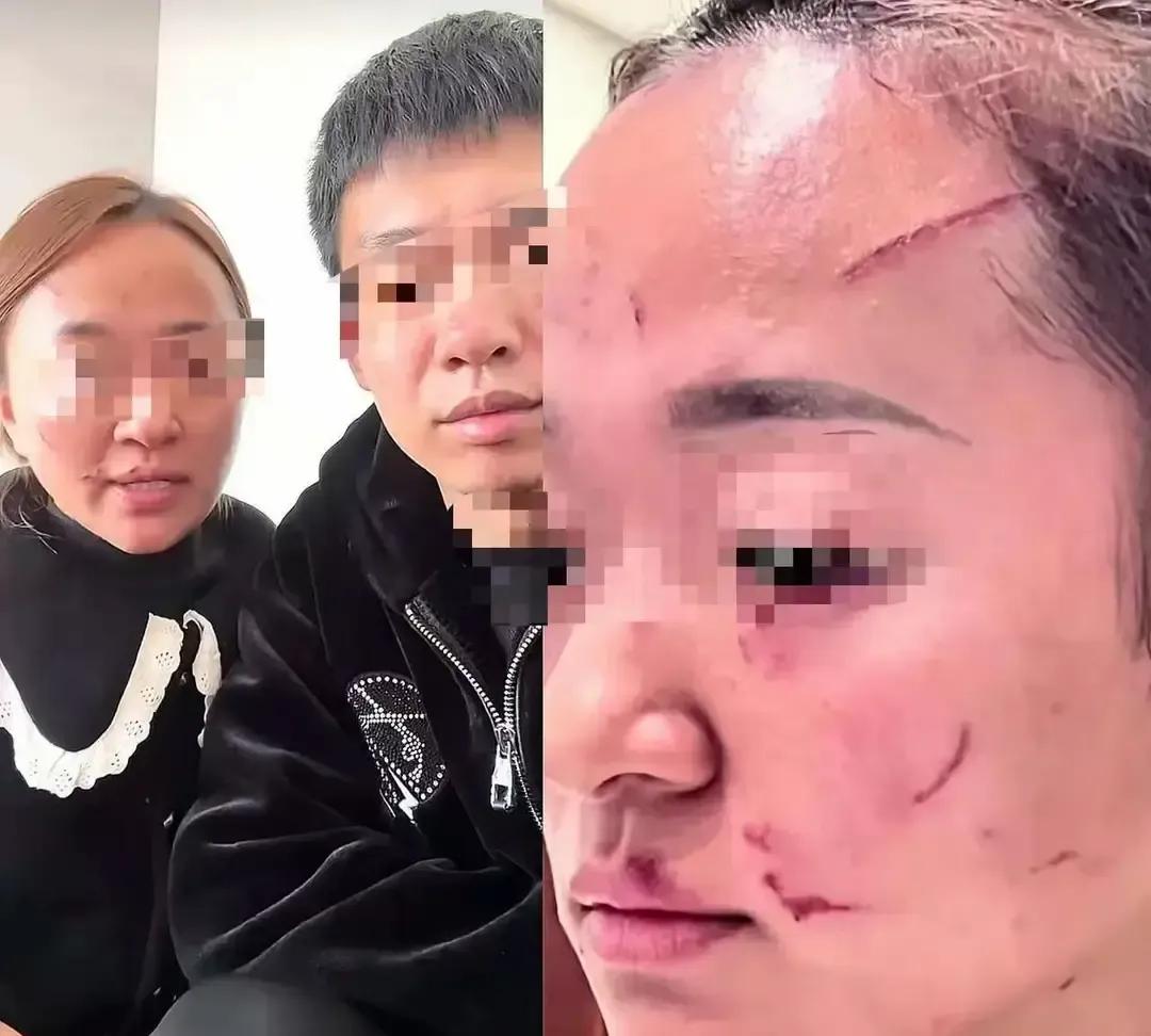 洛阳一小区婆媳因为给娃加不加辅食当场撕打。婆婆说米汤早喂才壮，儿媳拦着不让，一