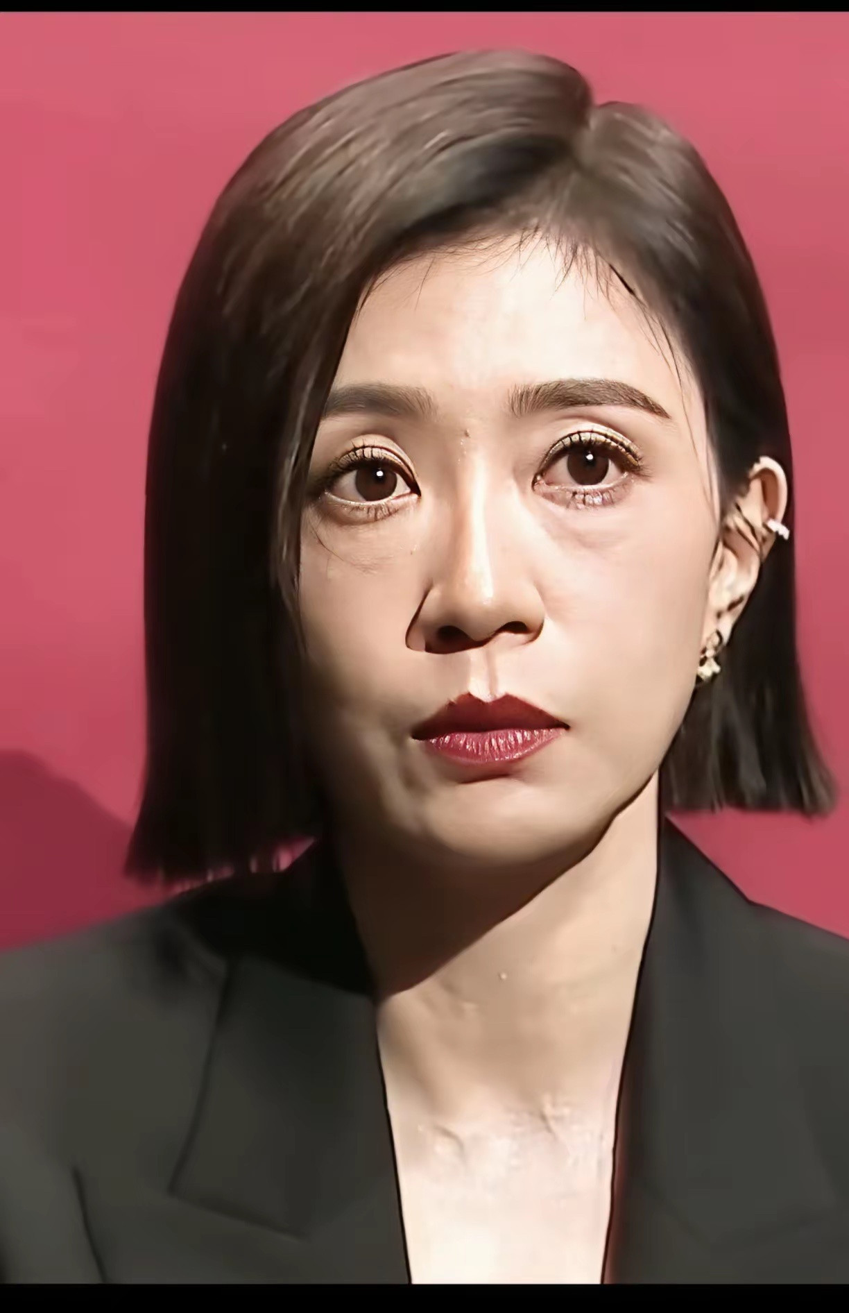 贾静雯眼袋黑眼圈也太明显了，如今医美这么发达，把眼袋去掉会更年轻。