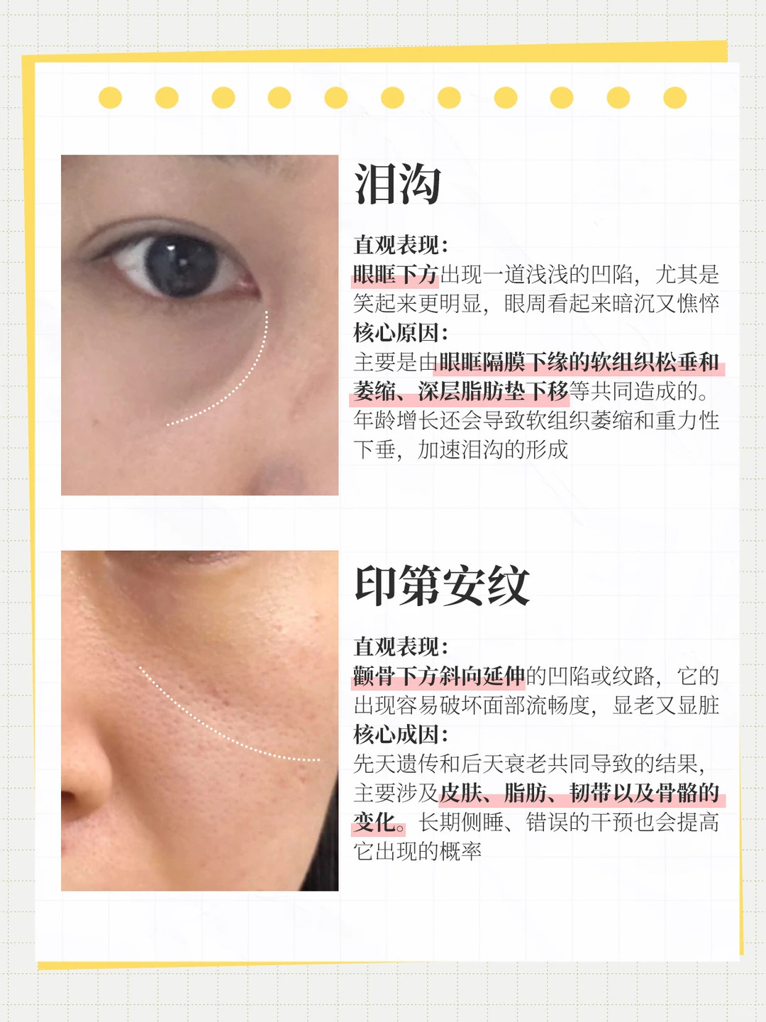 断崖式垮脸其实就是水毒中医早有定论：脸垮先看湿，抗老先调水。很多人花大价钱抗老却