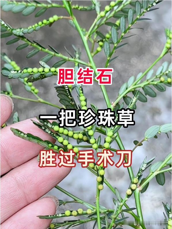 胆结石虽多为常见疾病，但结石在胆囊内不断增大，就如同胆囊里藏了一颗颗“小石子”，