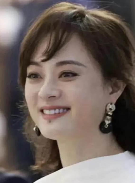 孙俪标志性黑痣“下岗”：背后的健康隐忧与网友争议