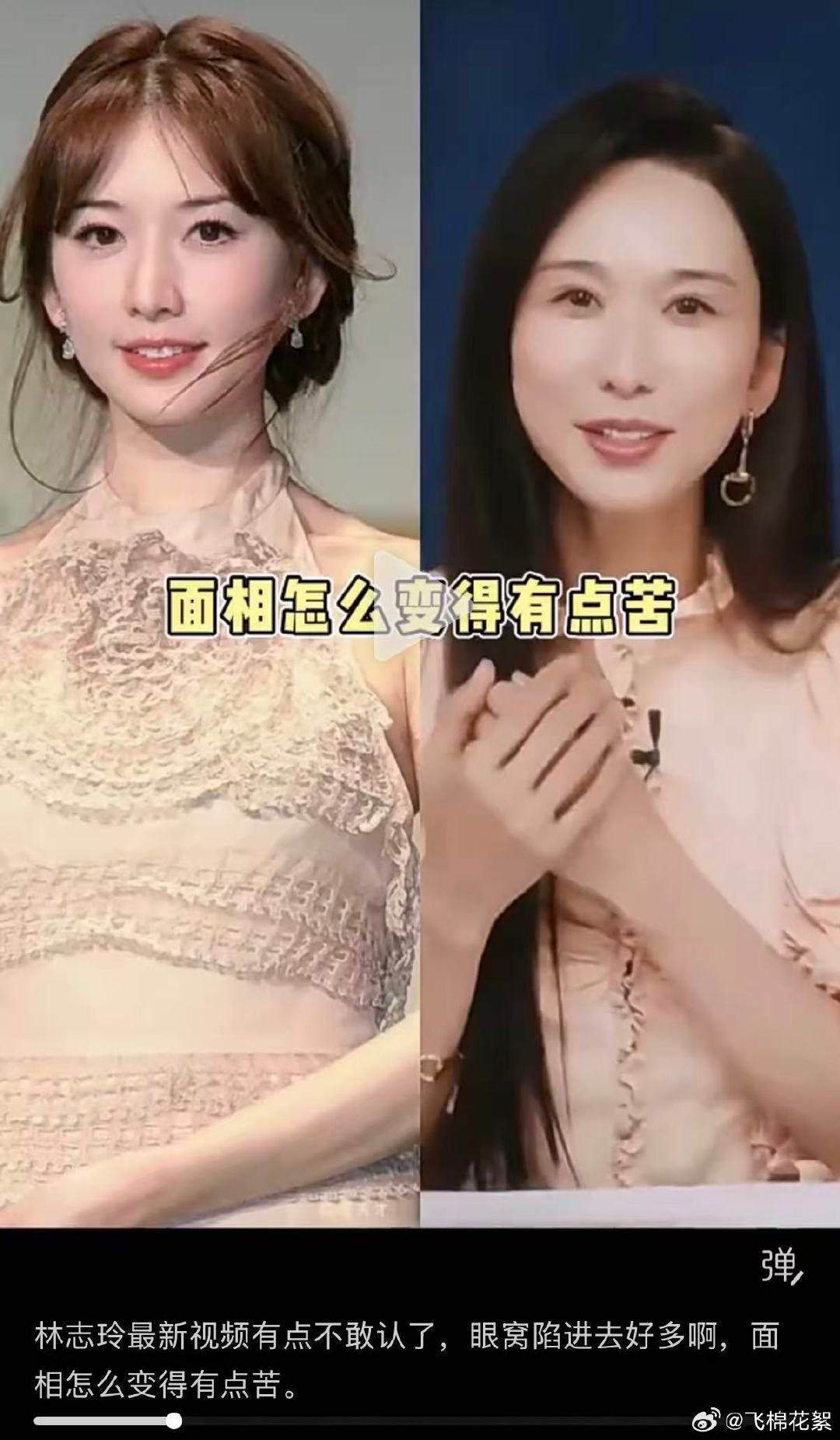 林志玲最新视频有点不敢认了，眼窝陷进去好多啊，面相怎么变得有点苦#小S是给自己生了个林志玲吧#​