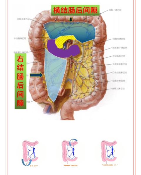 右结肠后间隙层面 横结肠后间隙层面 三刀: 三步走 一条根:小肠系膜根