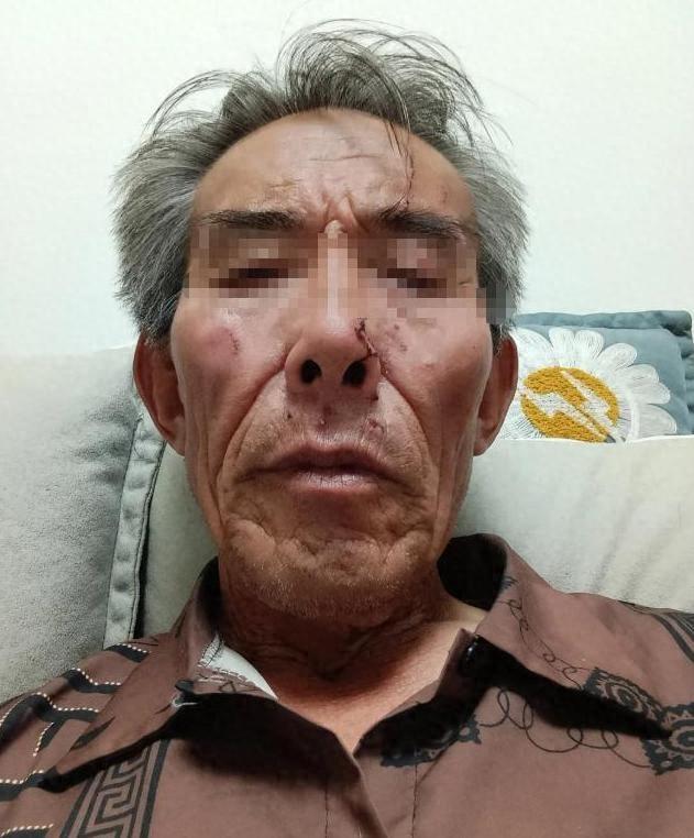 内蒙古遭殴打的保洁员已有68岁，是老党员兼退役军人，因在火山景区阻止乱扔烟雾棒，
