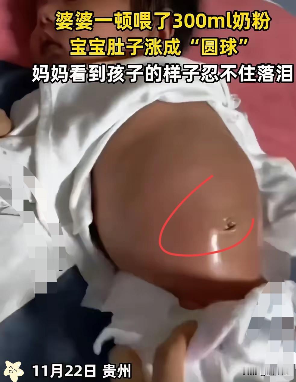 贵州，一宝妈去买菜，把孩子交给奶奶带，娃就被婆婆灌了300毫升奶粉，小肚皮撑