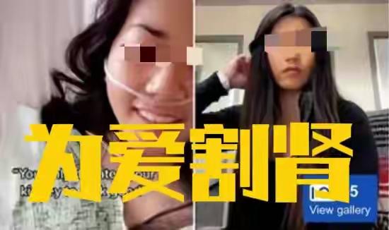 恋爱脑太可怕！亚裔女孩割左肾救白人男友，7个月后竟被拉黑!亚裔女孩科林·李为留