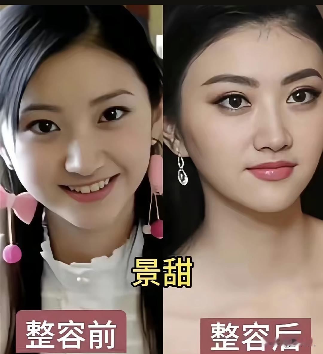 景甜整不整容，基本上没什么区别。她应该算是微整，景甜这么漂亮其实不用整容。景甜