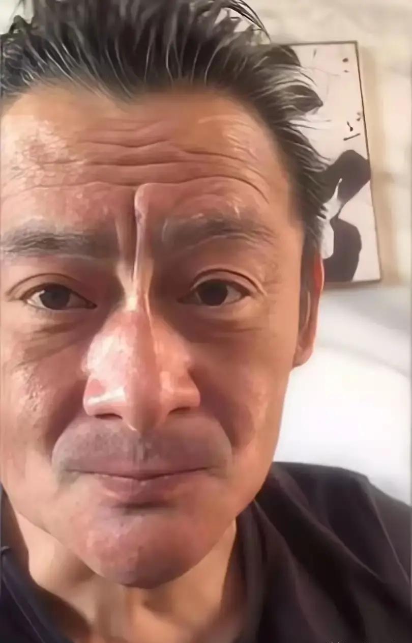 酒精正在偷偷给你换脸，不是慢慢变老，是直接撕走胶原蛋白。看看景岗山直播间的脸，