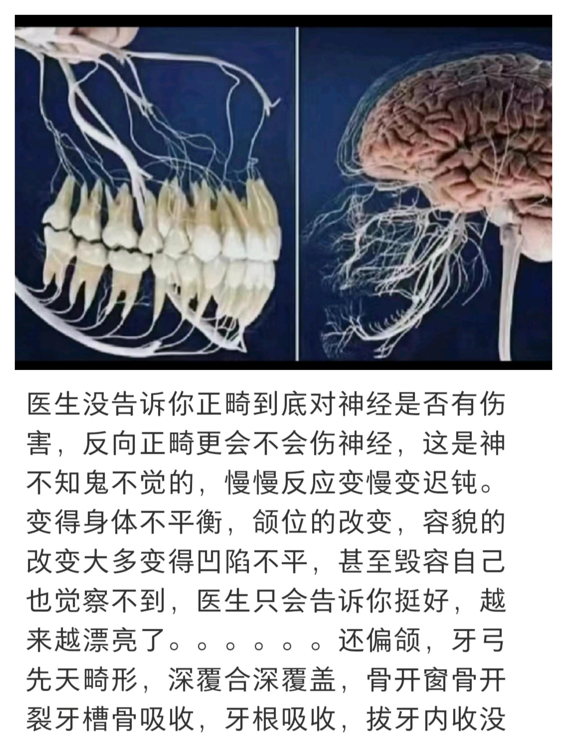 怪不得刘亦菲不整牙，原来这么可怕