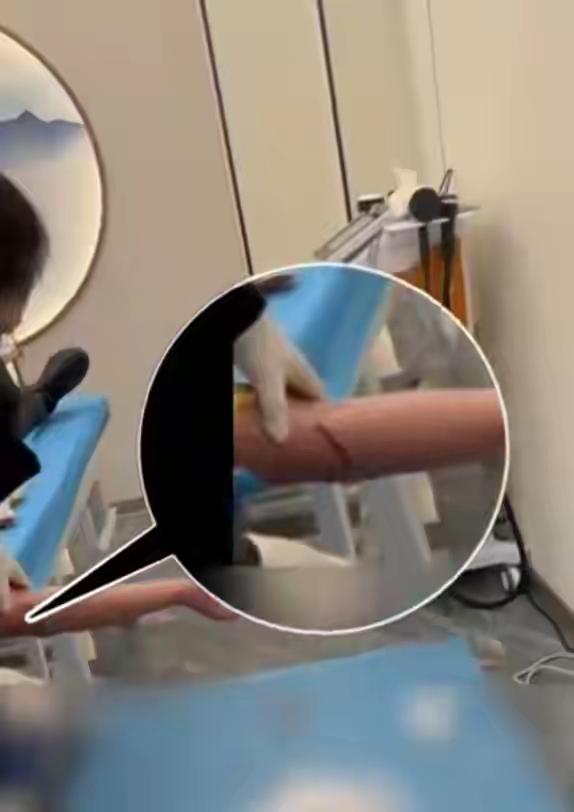 一黑诊所给顾客“放血疗法”，简称“排邪气，清淤堵”，你见过这样子的治病方式吗？