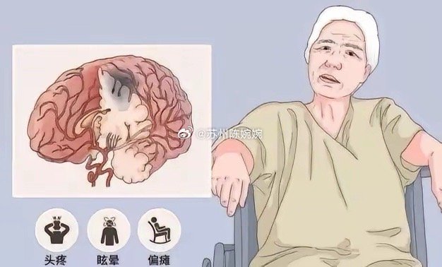 睡觉时出现这4种情况，或是脑梗找上门有“三高”的人，要特别关注一下1、出现手麻、