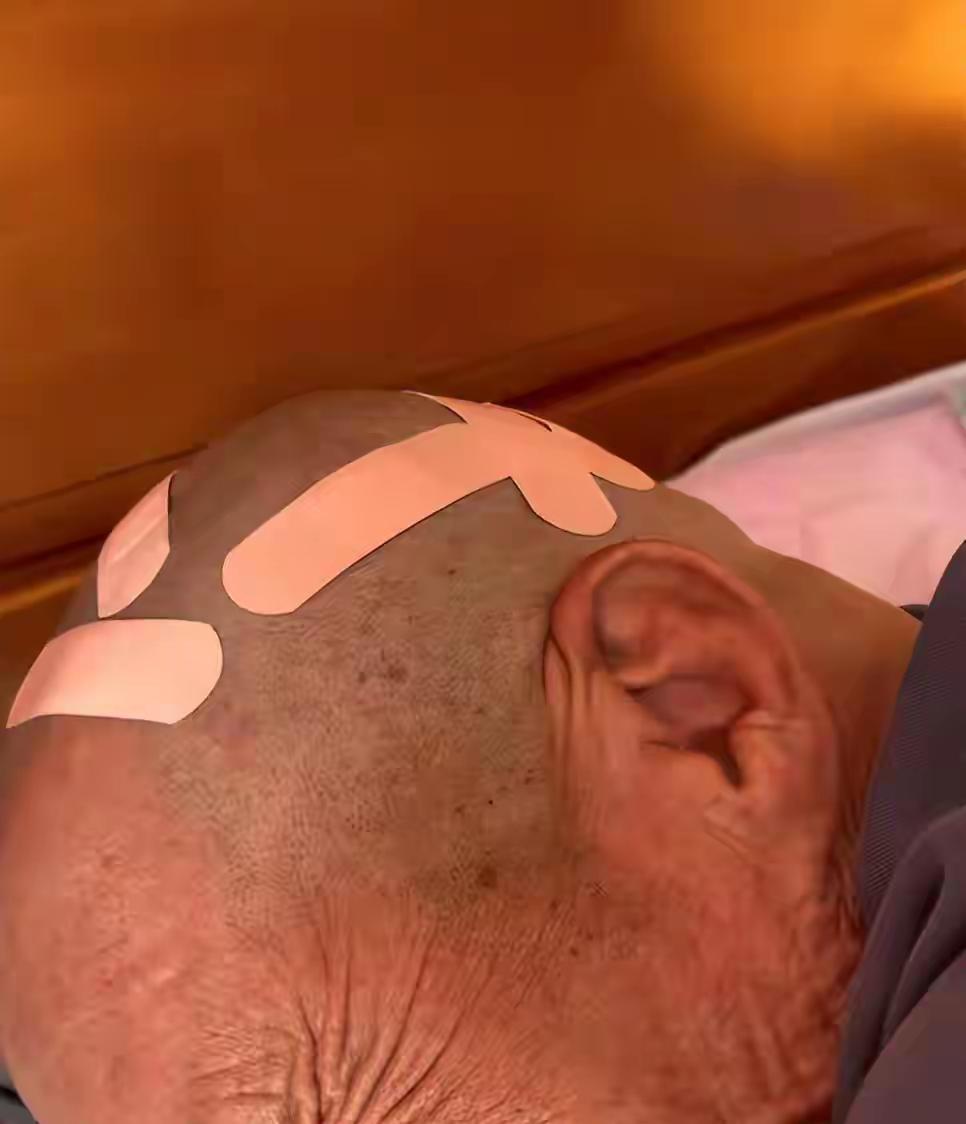 “又好气又好笑！”天津，67岁大爷花10元剃头，结果剔完满头都是伤口，女儿想找店