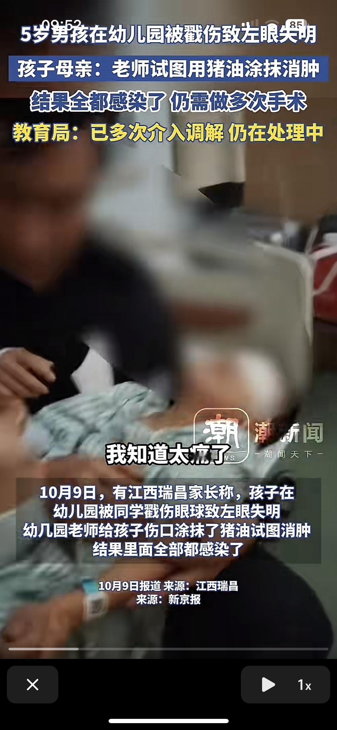 看着太让人心疼了！这么小就要承受这么大的痛苦，这是27万可以买来的吗？5岁的孩