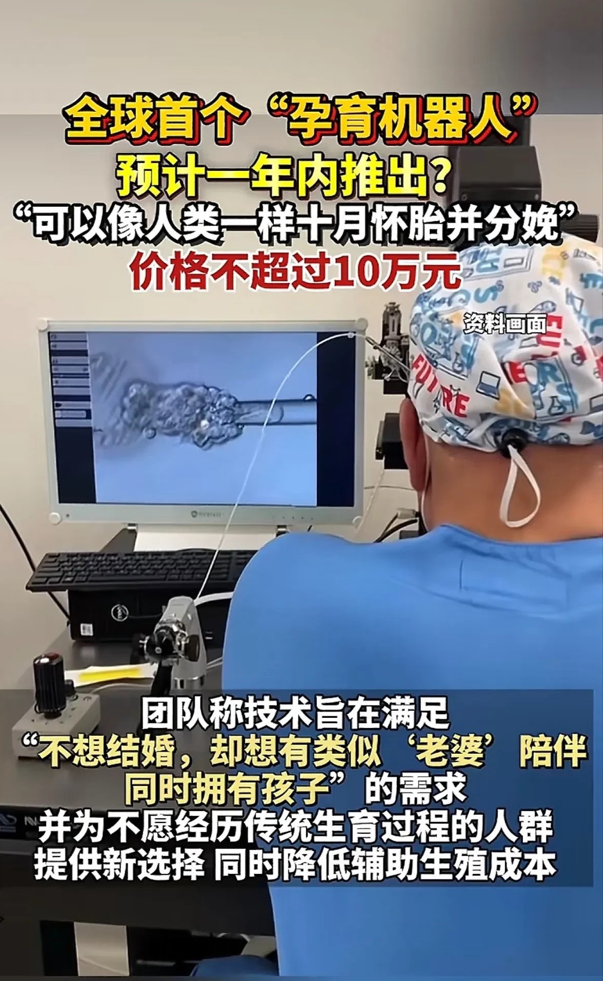 听说孕育“机器人”将在一年内推出，可以十月怀胎并分娩，我婆婆他们天天催我生二胎，