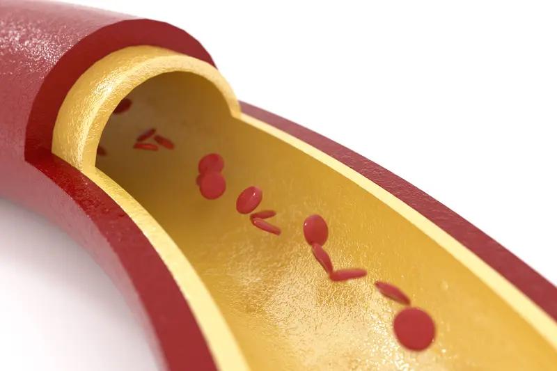 现在越来越多人出现血管堵塞，和生活方式脱不了干系。就说饮食，很多人无辣不欢、无肉