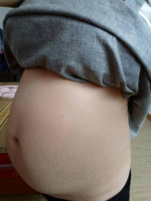 孕妇怀孕8月突然见红, 送医后婆婆签字剖腹产, 丈夫说“不要救”