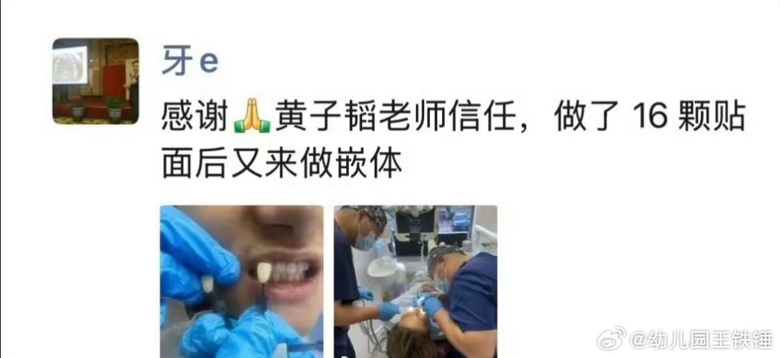 黄子韬做了16颗牙贴面换谁都会生气吧，看牙也算是患者了，保护患者隐私不是医生应该