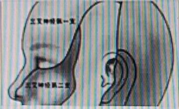 耳朵一直响真的太折磨人了，像有只蚊子在脑子里打圈，严重影响心情和睡眠。其实中医里