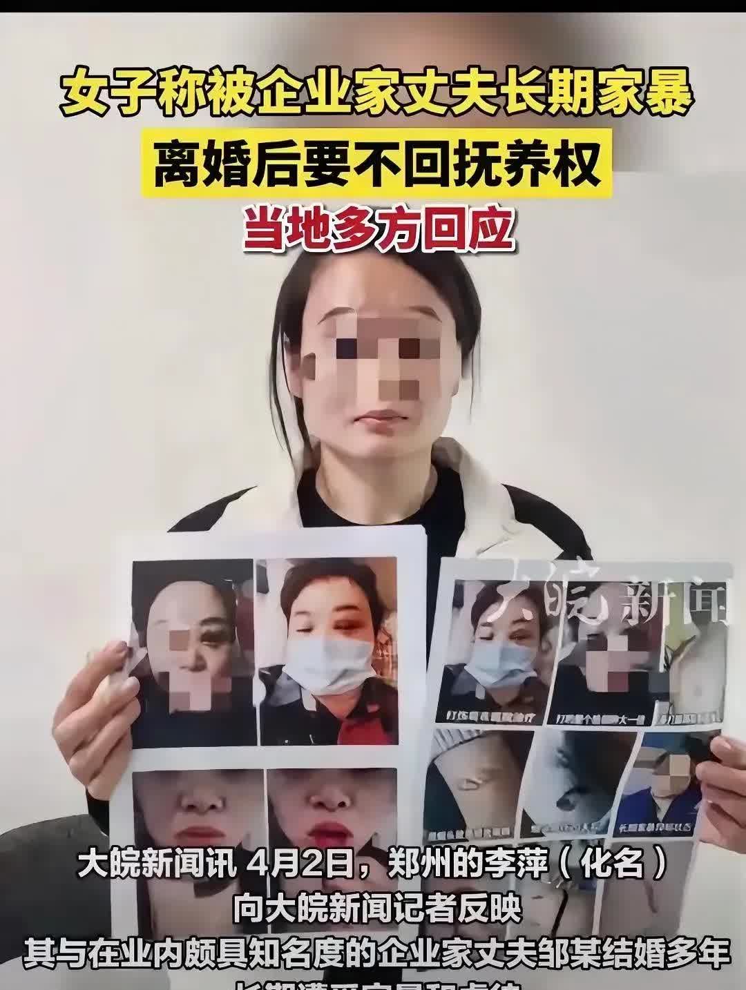难以想象，在郑州，李萍竟被丈夫长达七年的折磨。在这漫长又黑暗的七年里，丈夫用烟头