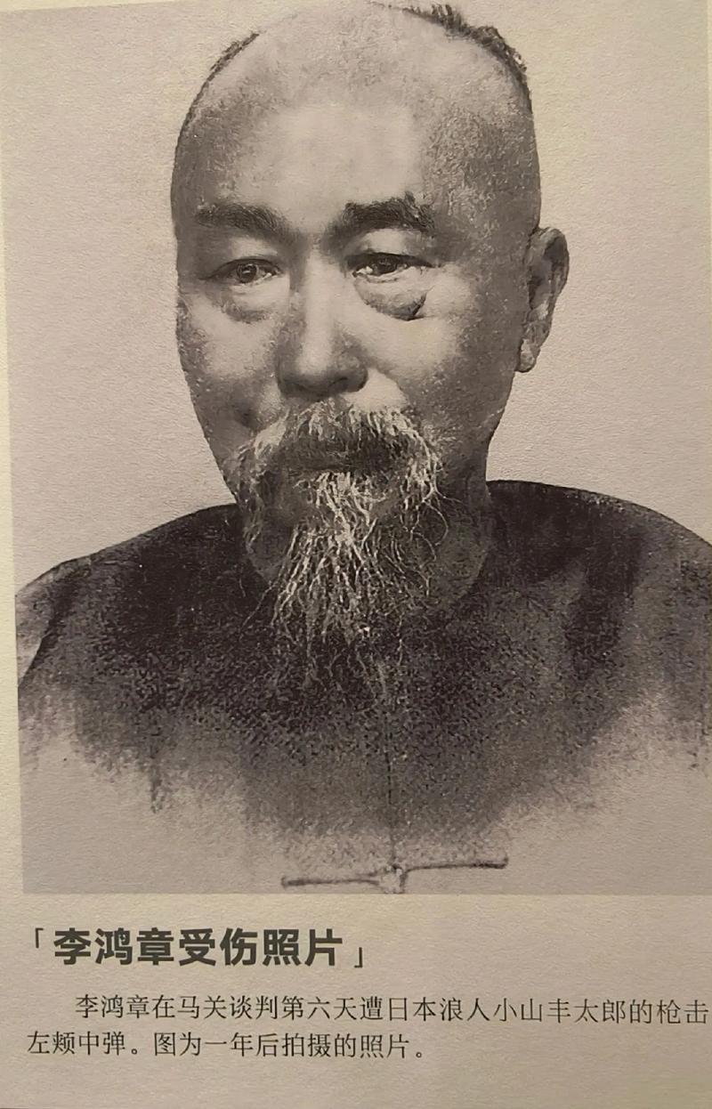 1895年，日本浪人的一枪击穿了李鸿章的左脸。为了把赔款从3亿两砍到2亿两，73