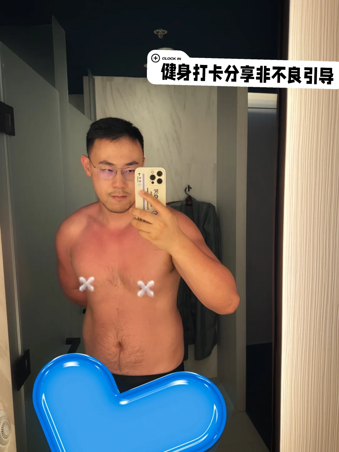 展示妥妥晒红晒伤