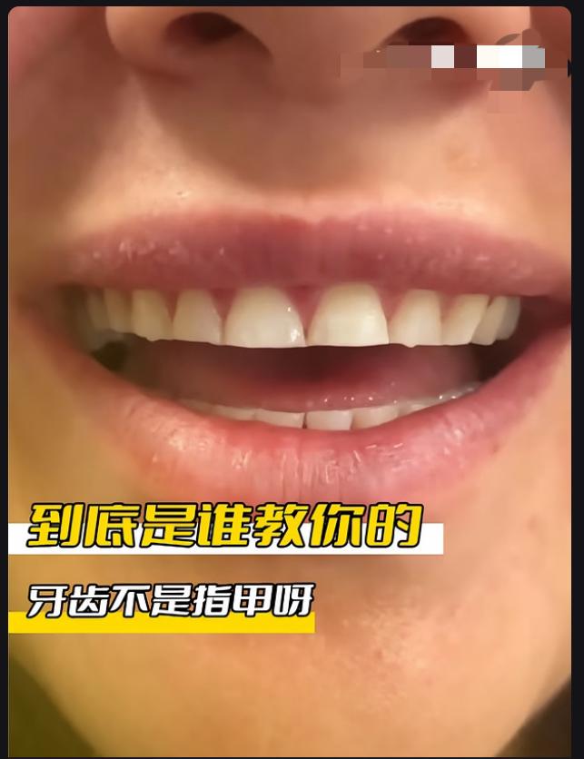 你们最近刷没刷到，这个女生，嫌自己的牙齿长得不齐，她竟然，把自己的牙给磨齐了