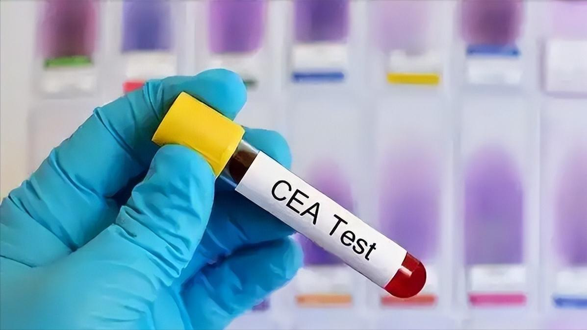 肾病若没这几个信号，基本不用慌，别自己吓自己最近身体一不舒服，有些人就开始在