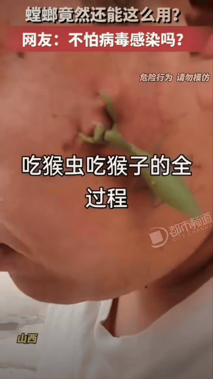 真勇啊！山西，一名男生脸上长了瘊子，本来就是一件很普通的皮肤小问题，正常人第一反