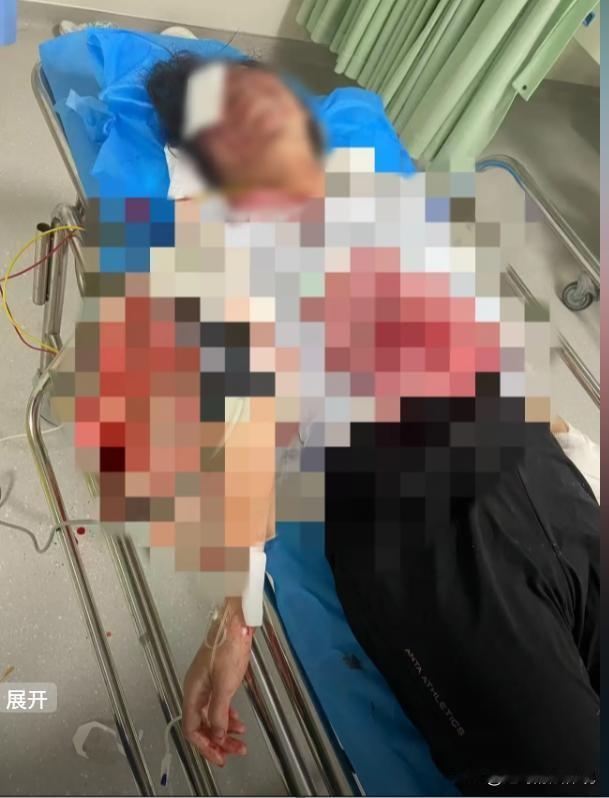 福建云霄，27岁女子和男友分手，前男友怀恨在心，在女子电动车上装了炸药。女子出门
