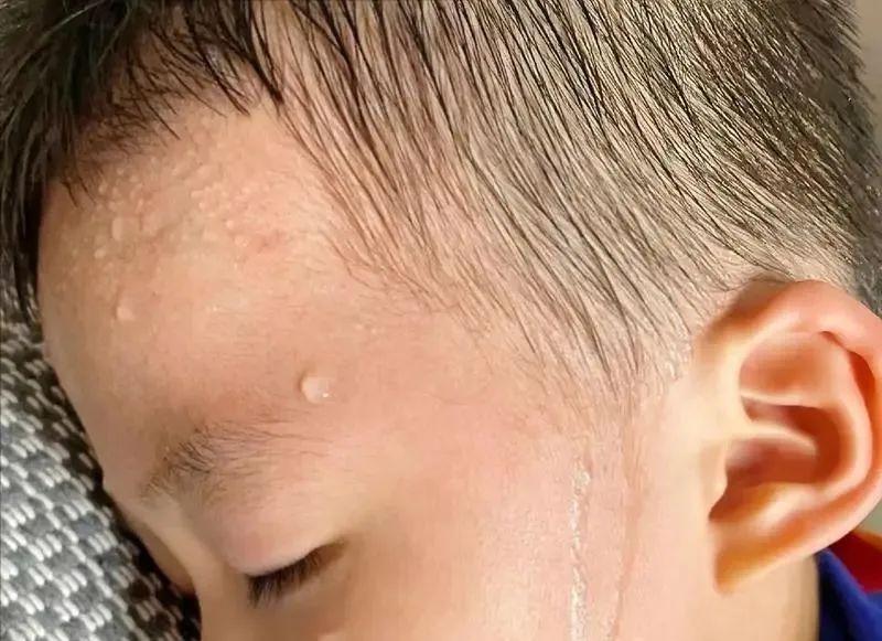 内热重爱生病，出汗不止鼻炎反复的孩子，这3碗补津汤，千万别错过！孩子内热重，
