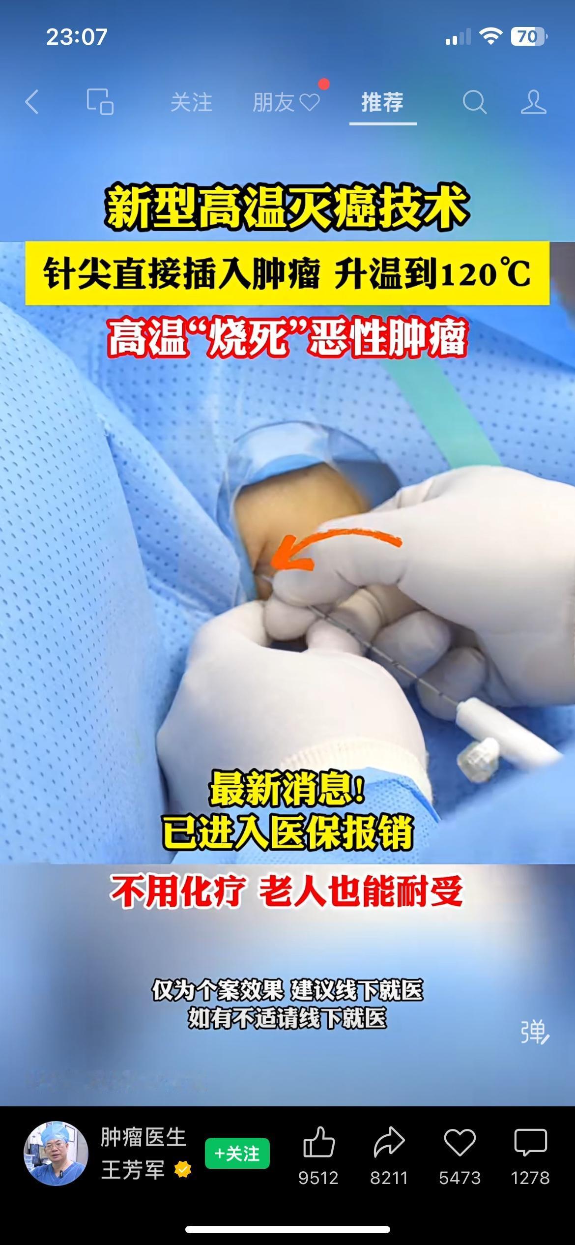 高温灭癌技术进医保，患者少遭罪还省钱新型高温灭癌技术纳入医保了，用针尖对准肿瘤