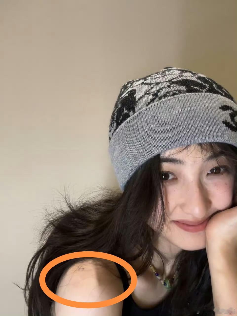 张子枫身为“国民妹妹”，本应该传递正能量，却在肩膀上纹身，被质疑误导和带坏未成年