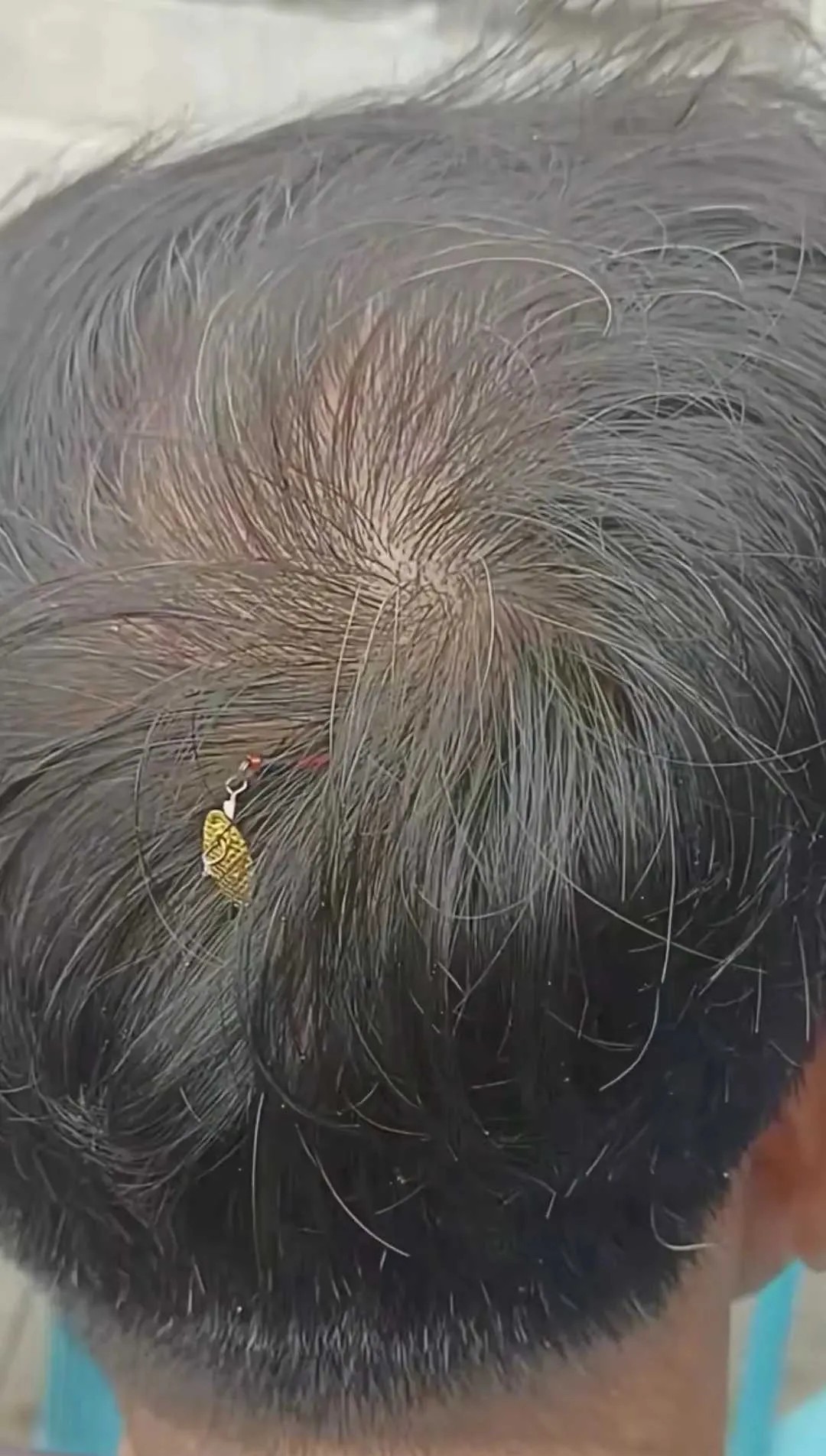 别说是他，我看着都疼！！！