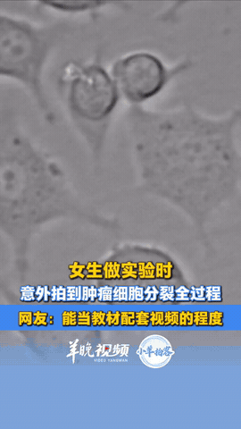 太幸运了！加拿大，女子做研究，观察癌细胞的变化情况，结果她看着看着，发现其中一个