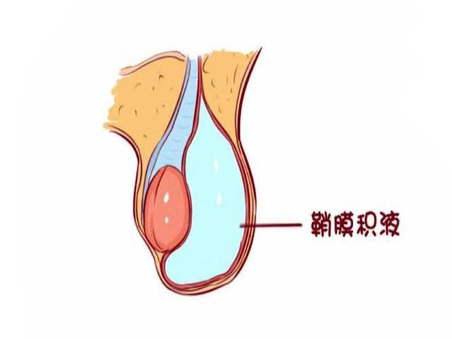 3岁宝宝"蛋蛋"一大一小, 送去医院检查后, 医生说