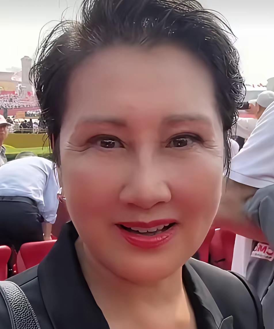 看张凯丽，尽管脸颊光滑细腻，可眼周却布满深深的皱纹，使得整张脸看上去颇为怪异。