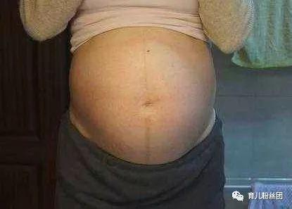 孕妈剖腹产一男婴却因病离开, 留下3月大宝宝