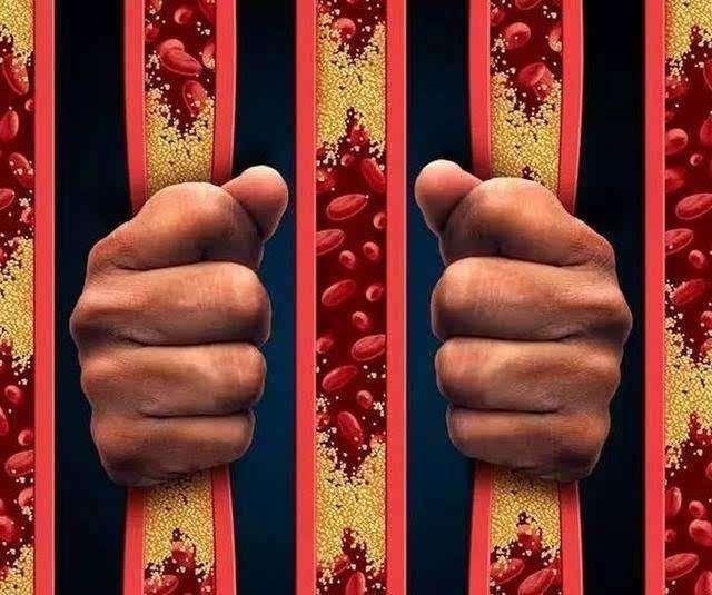 耳朵这处有变化, 暗示你血管不好了! 逼退动脉硬化只需这3招!