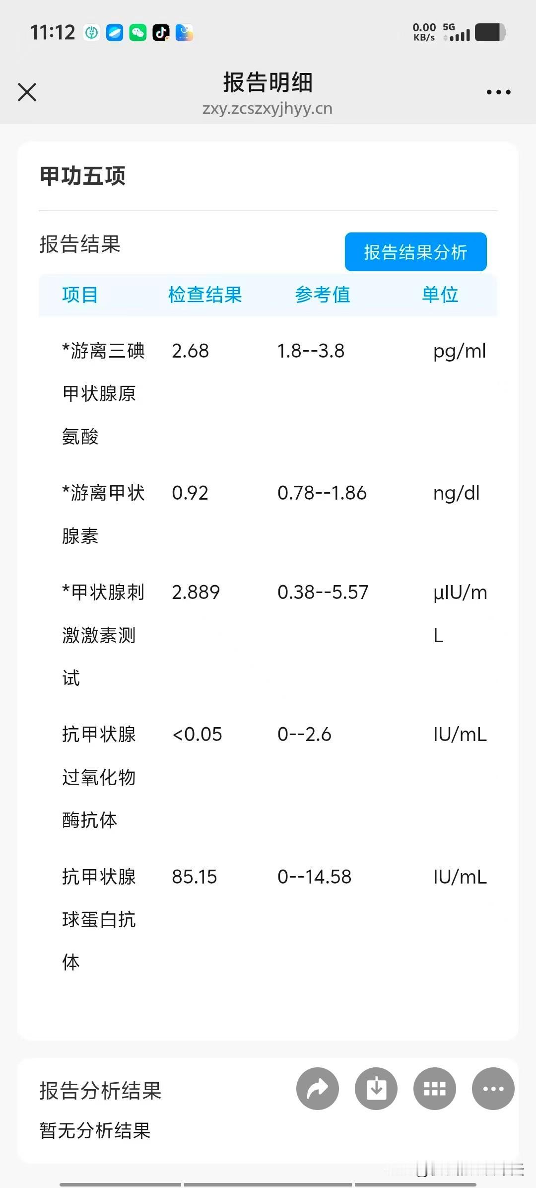最近我感觉特别乏力，腿酸，肌肉酸痛，去年查过甲状腺，前四项正常，最后一项是72，