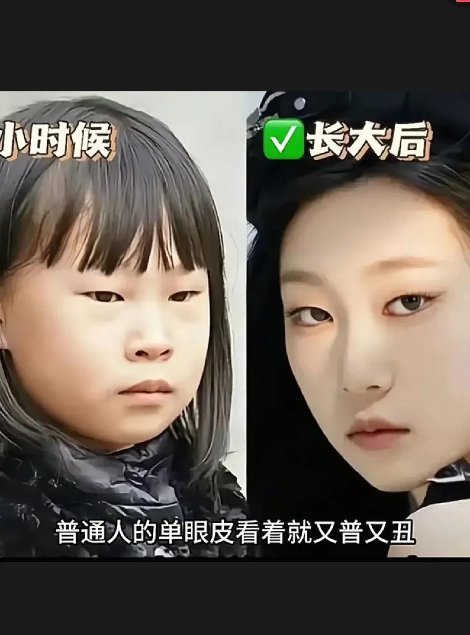 小沈阳的女儿小时候就是丑小鸭的代表。长得特别像小沈阳，尤其那一双小眯眯眼儿。
