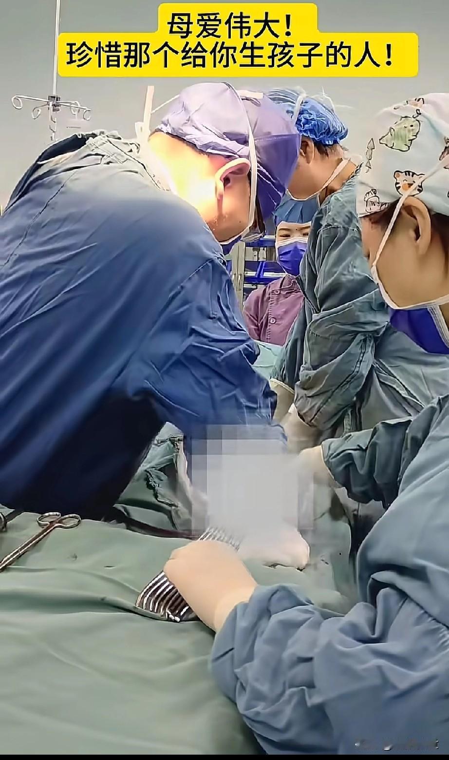 剖腹产四大酷刑，下地走，缩宫素，按肚子，拔了尿管上厕所，你们觉得哪个最痛？[流泪