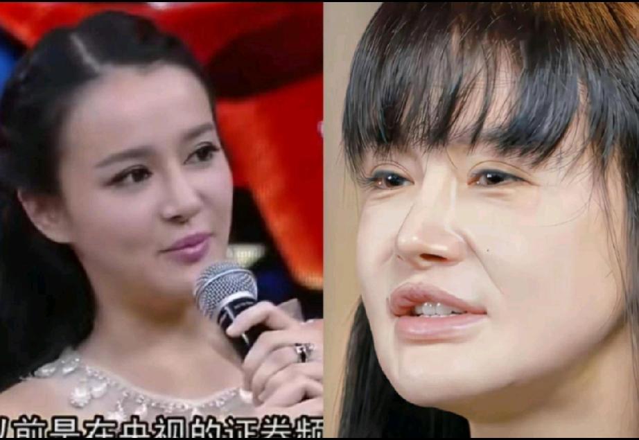 做医美的闺蜜看了冉莹颖现在的样子说，这个女人真狠，整个脸全是科技和狠活，动的