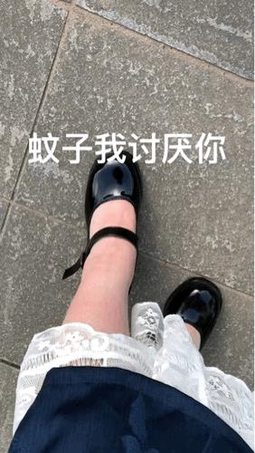 这儿的蚊子太厉害了，脚脖子都叮肿了[笑着哭]