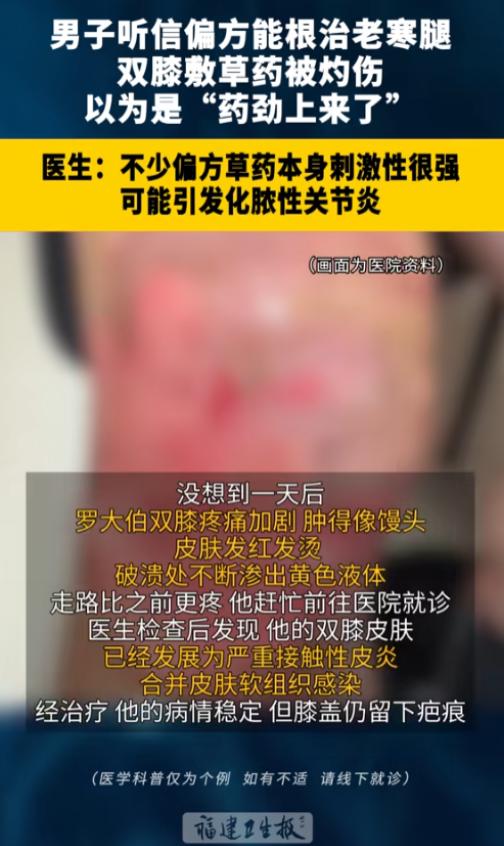 “偏方需谨慎！”浙江杭州，一老人膝盖疼痛多年却一直惧怕做手术，后来他听说了一个偏