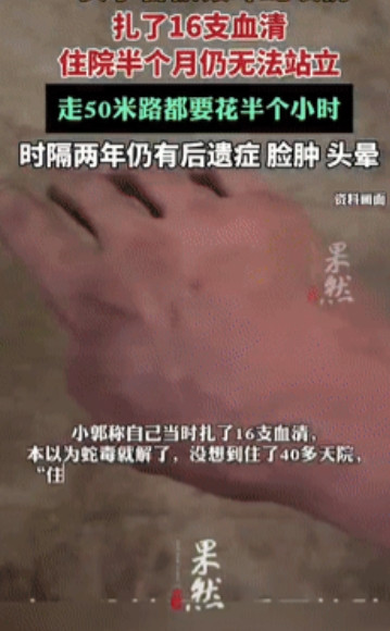 “命真大！”近日爆出，一女子和丈夫在两年前去云南普洱旅游时，在酒店的床上不幸被银