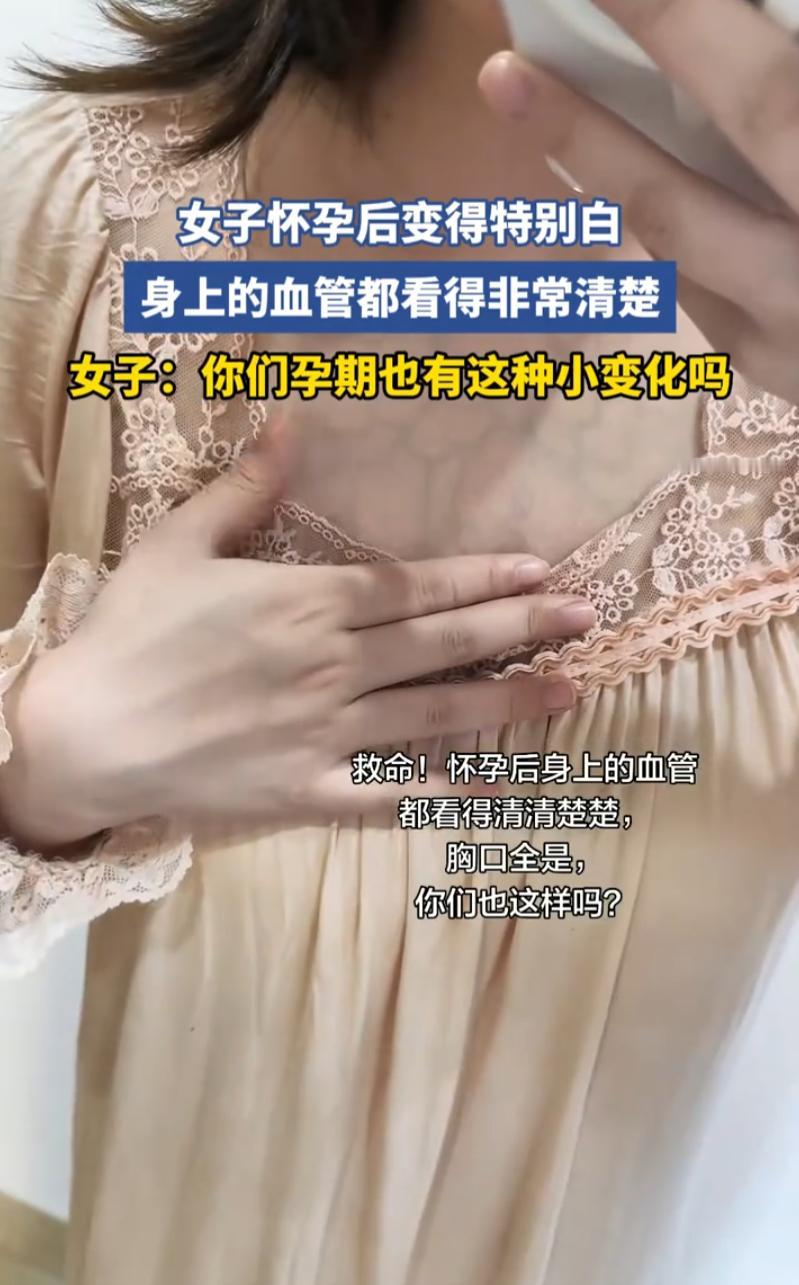 福建，一女子备孕顺利怀上宝宝，怀孕一段时间后，最先察觉到肤色转变。原本肤色普通，