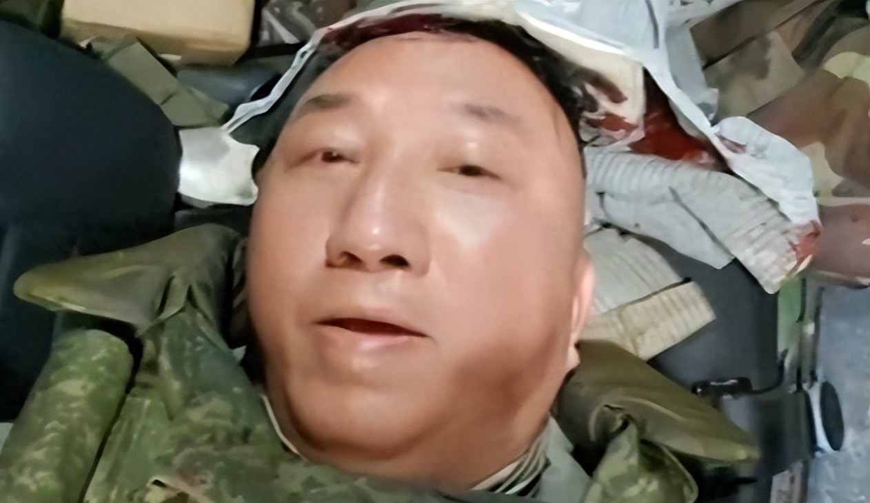 记者前线遇袭，真相不容掩盖太可怕了！中国记者在前线差点没
