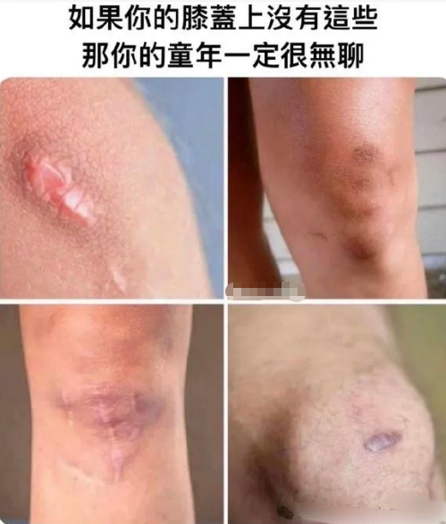 我的童年不无聊