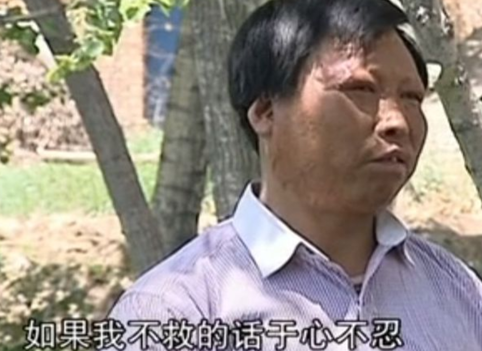 2006年，青海一家具厂燃起大火，工人舍命救下老板孩子被烧伤毁容，事后老板却杳无