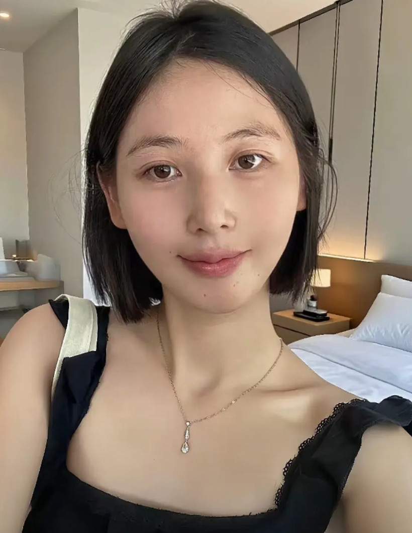 医美做成这样算成功了吧？